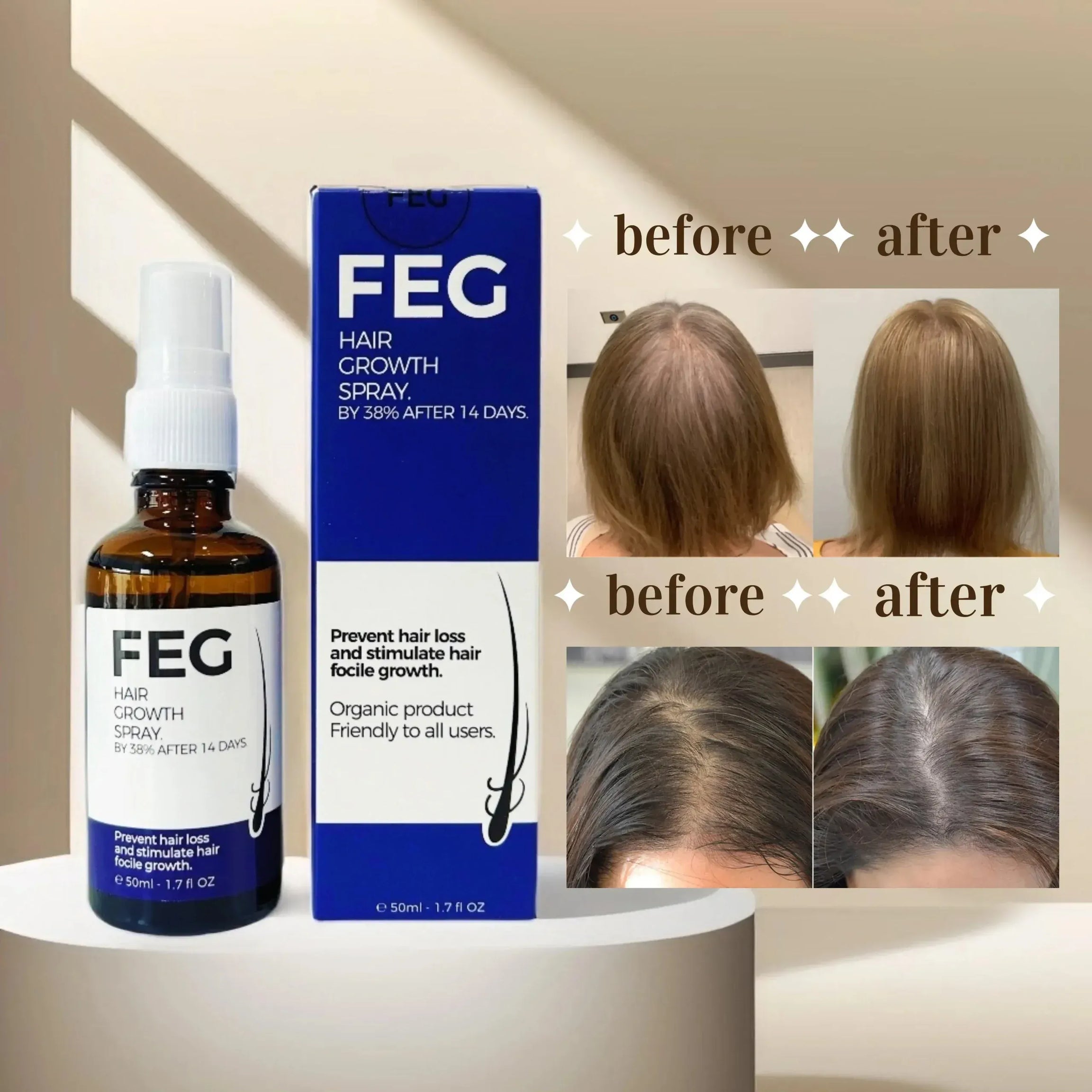 FEG PLUS - Hair & Beard Regrowth Spray – Anti Hair Loss Formula with Minoxidil, Redensyl & Natural Extracts (50ml) Export Quality